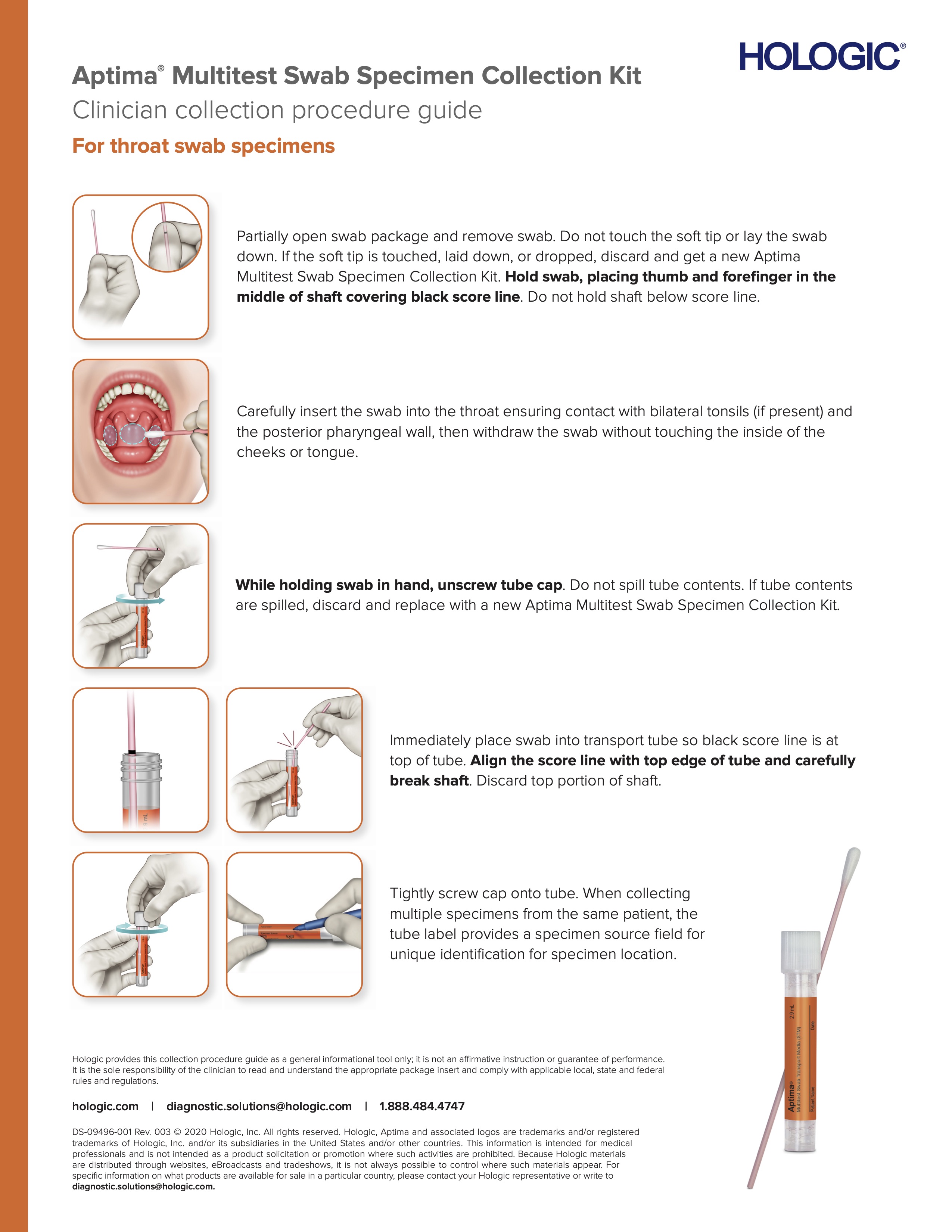 Gonorrhea Chlamydia Testing Swabs UCSF
